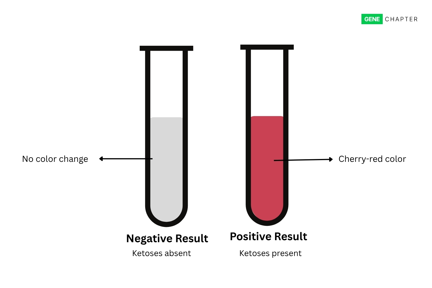 Seliwanoff’s Test: Principle, Procedure, Result, Uses